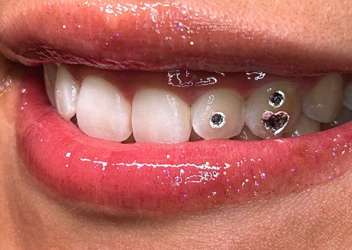 💎 Shape Tooth Gems 💎