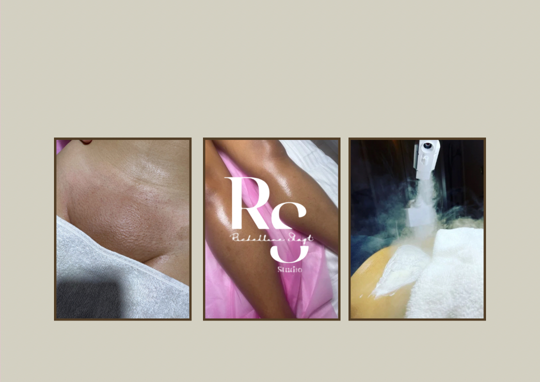 Ingrown Eliminator Vajacials