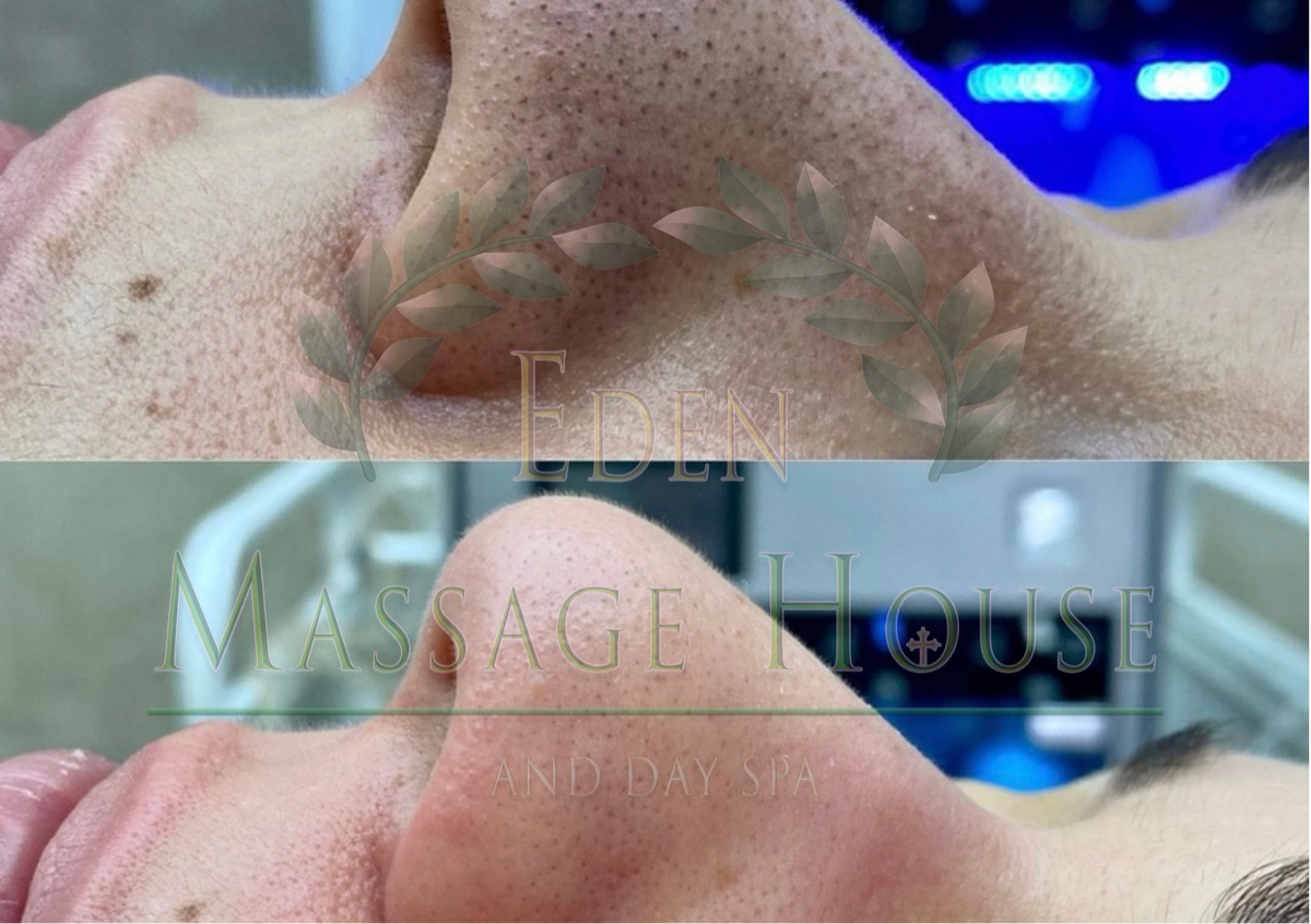 Deep Cleansed Facial