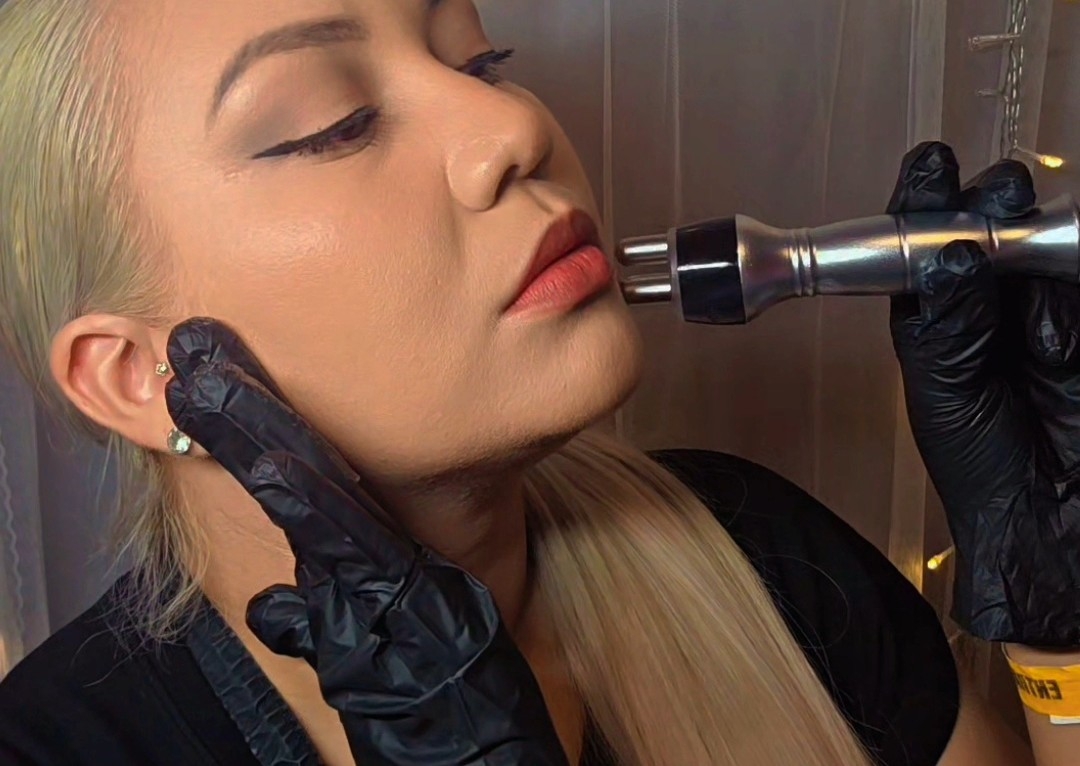 RadioFrequency Facial