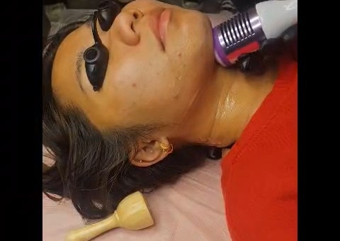 Refined Chin Treatment🧖‍♀️