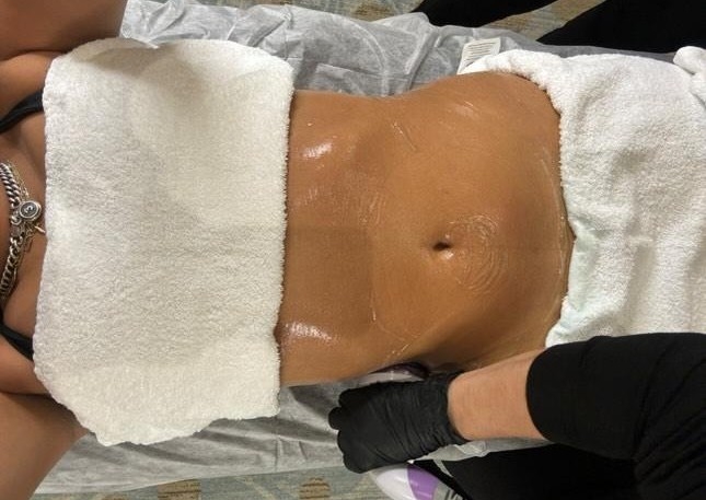Body Contouring (1) Session 