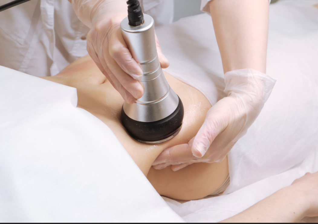 Cavitation Promo Deal 