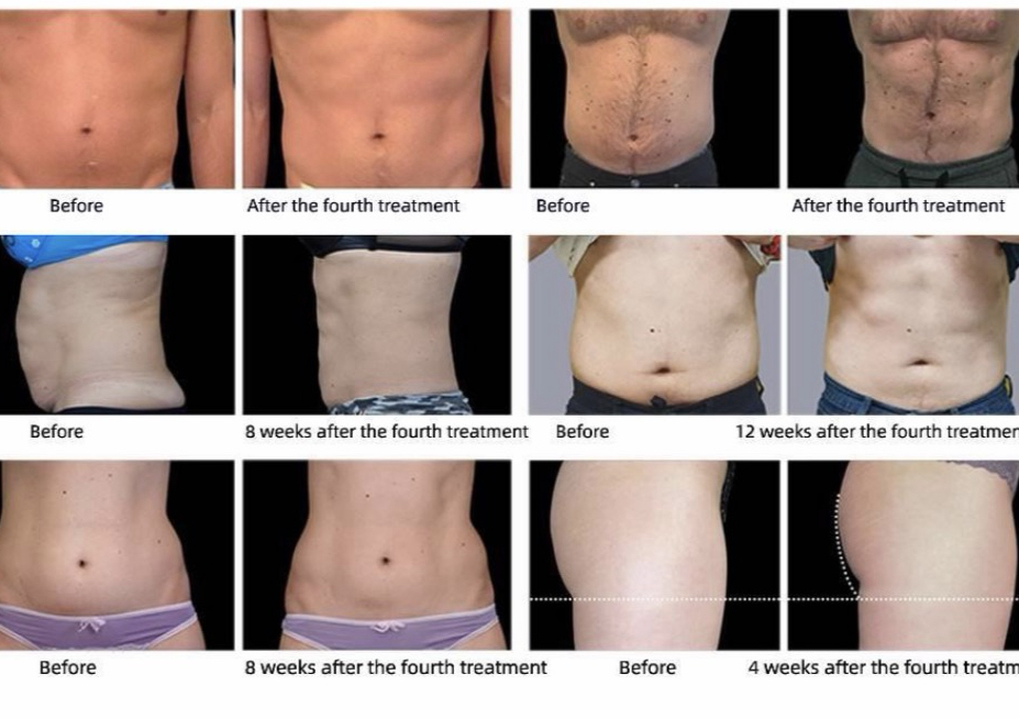 Intro Body Sculpting Muscle Building