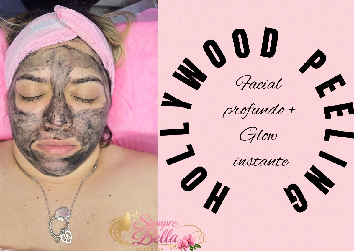 Hollywood peeling