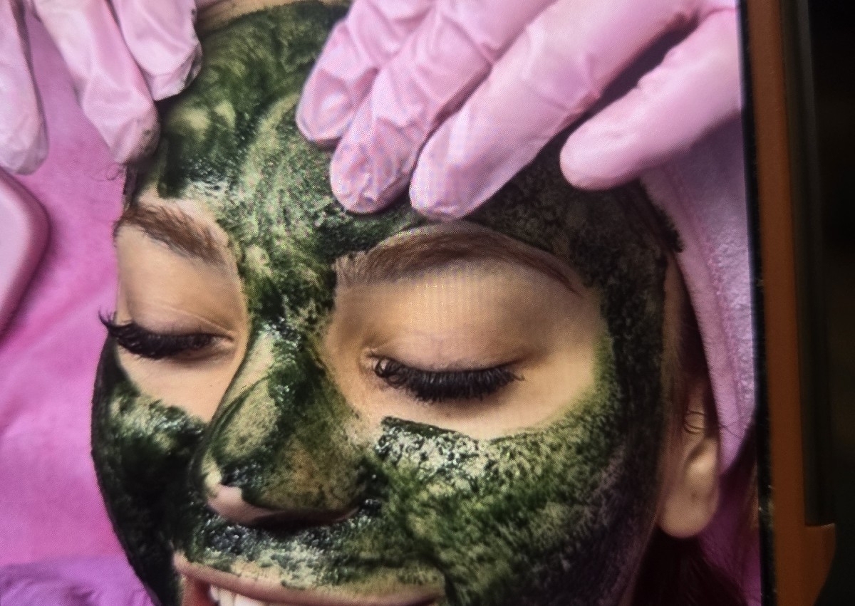 Green Peel (established patient) 