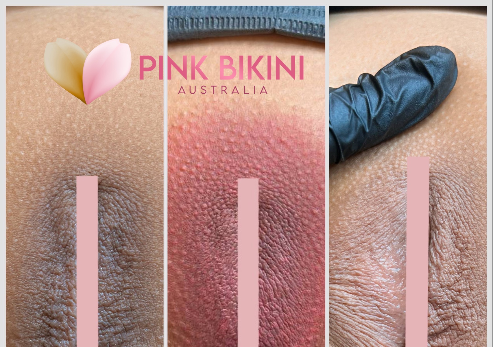 Intimate Tattoo Lightening