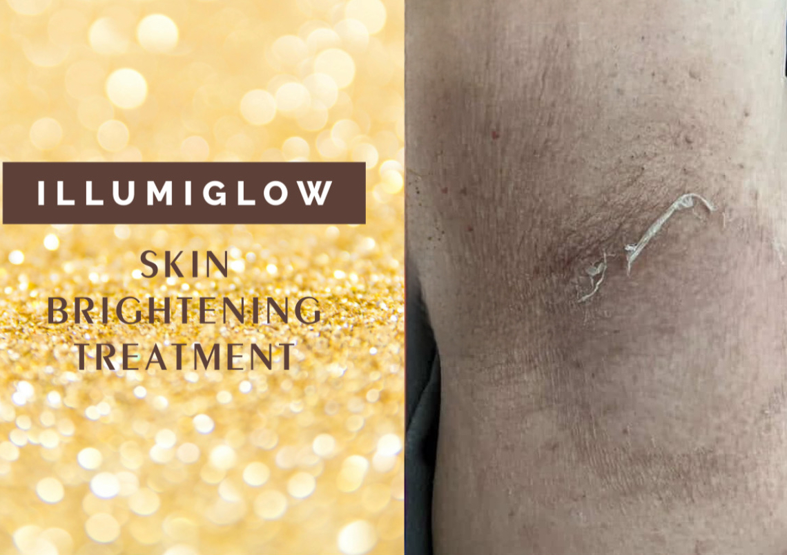 iLLumiGLOW armpit brightening