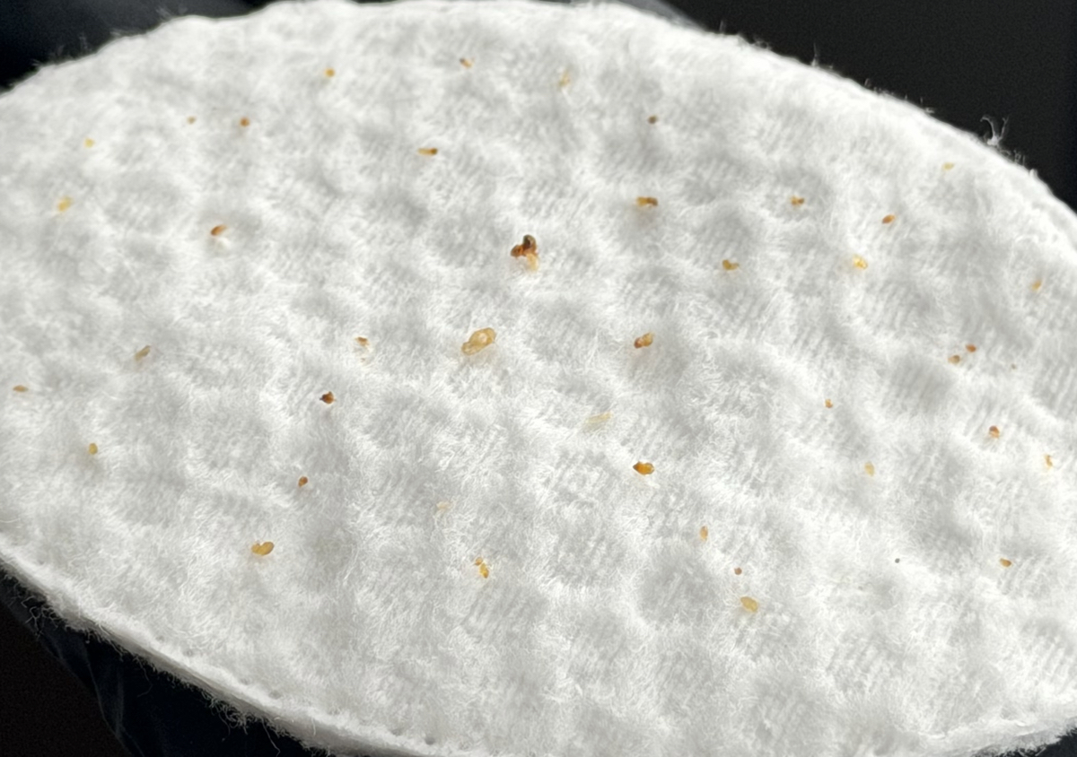 Manual Extractions 