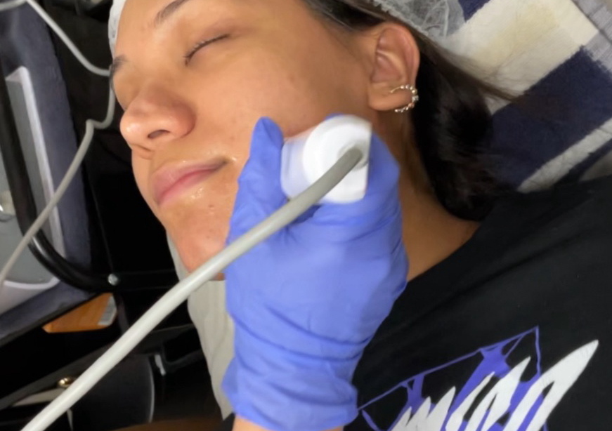 Tratamintos faciales con radiofrecuncia y luz led 