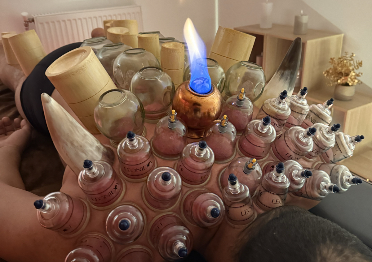 Hijama/cupping + scrapping 