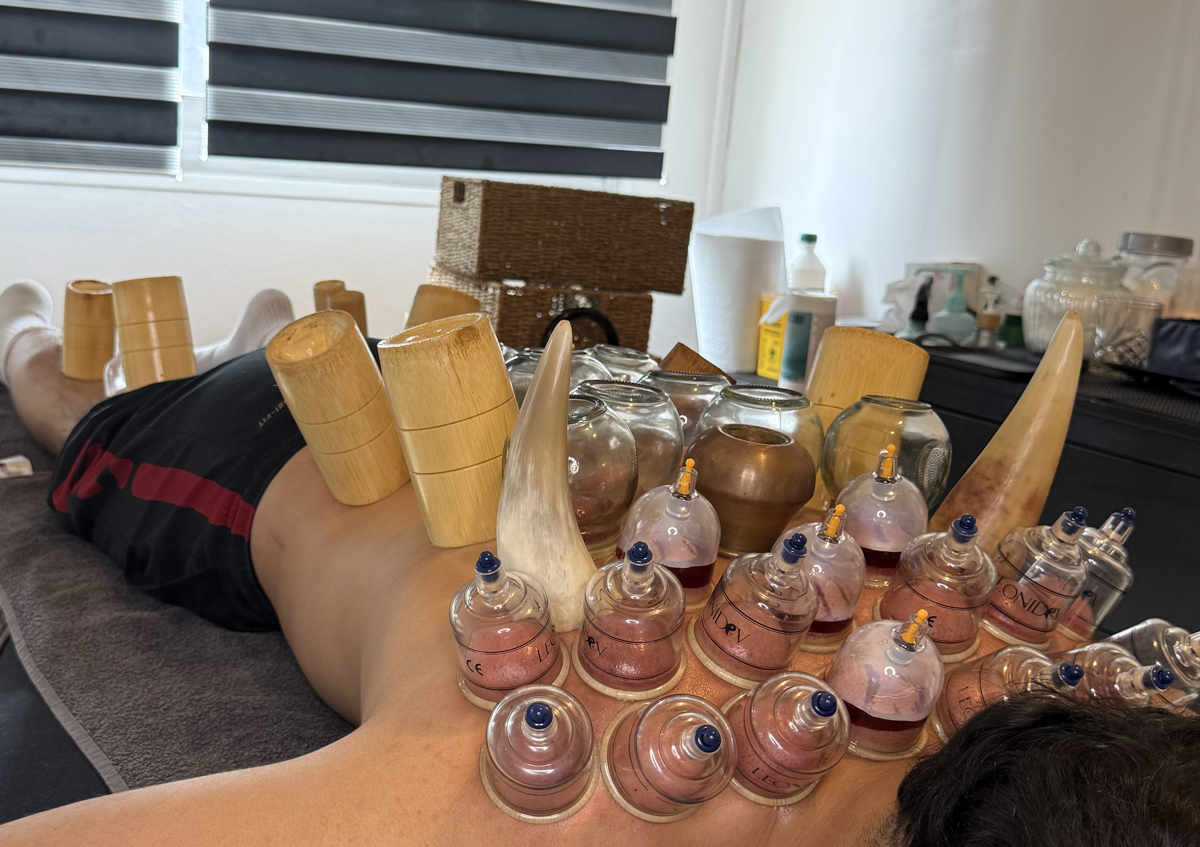 Hijama/cupping dos et jambe