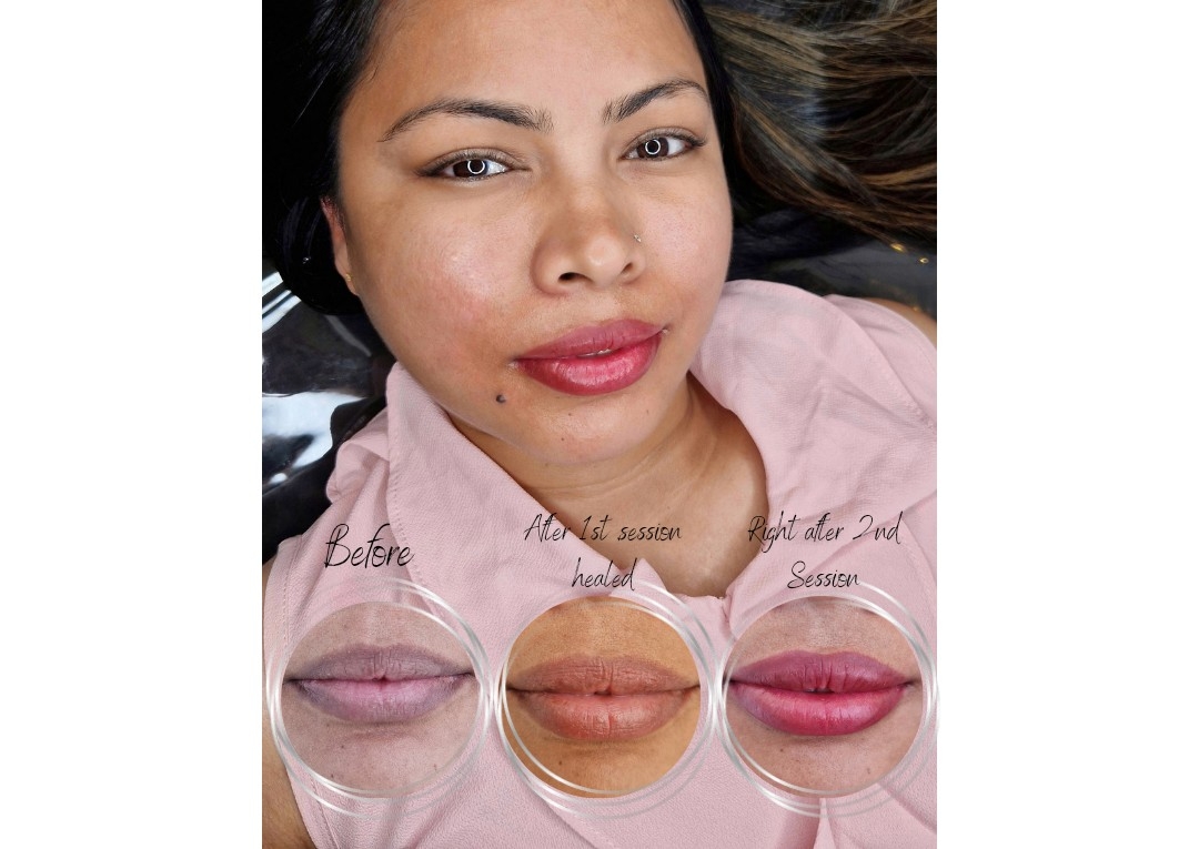 Dark Lip Neutralisation 