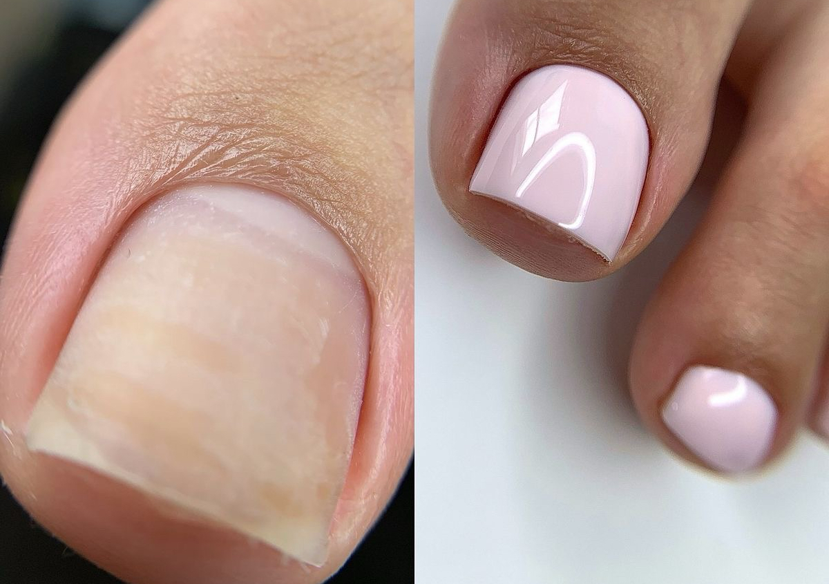 Classic pedicure 