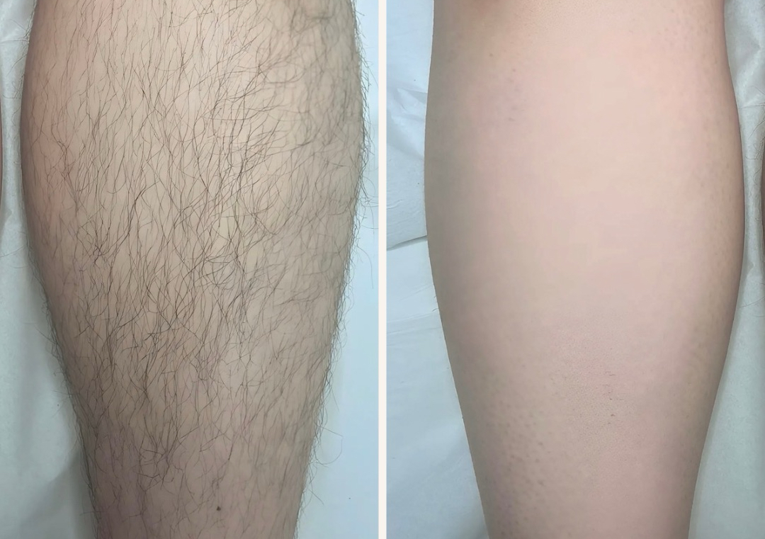Full legs Wax