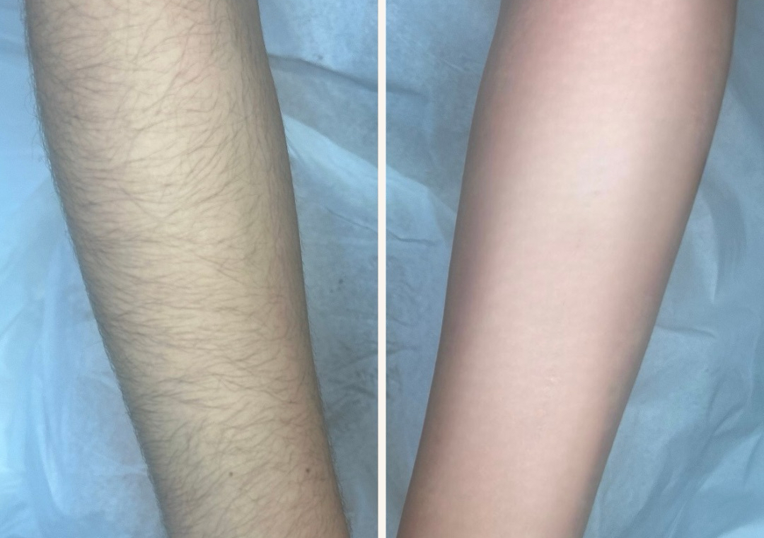 Full arms Wax