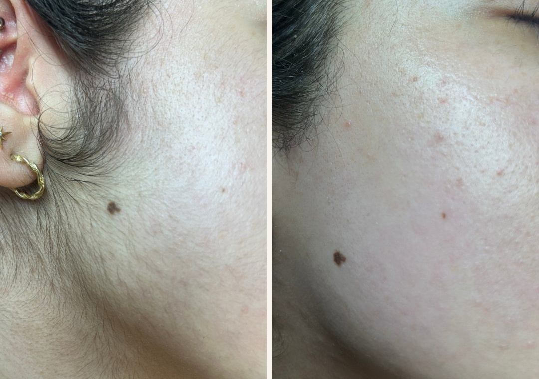 Full Face Waxing/Threading(includes brows )