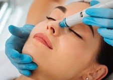 Hydrofacial with Acids 
