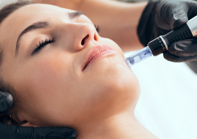 Microneedling