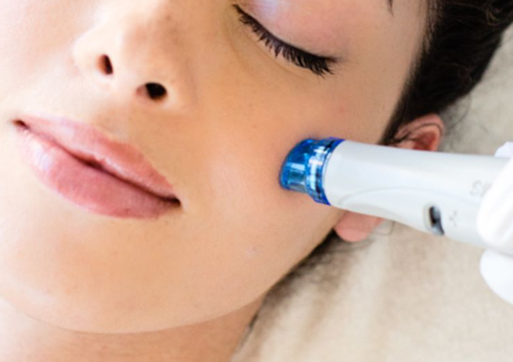 Hydra facial delux 