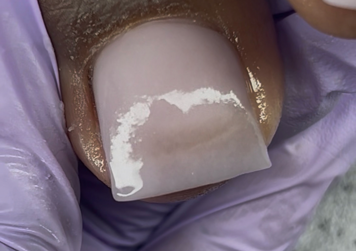 Polygel overlay (Big toes) 
