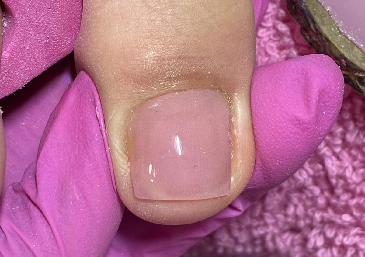 Acrylic Toes 