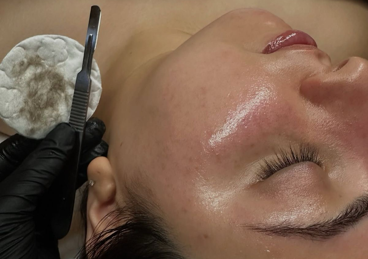 Dermaplaning- Piel de Cristal 🪞