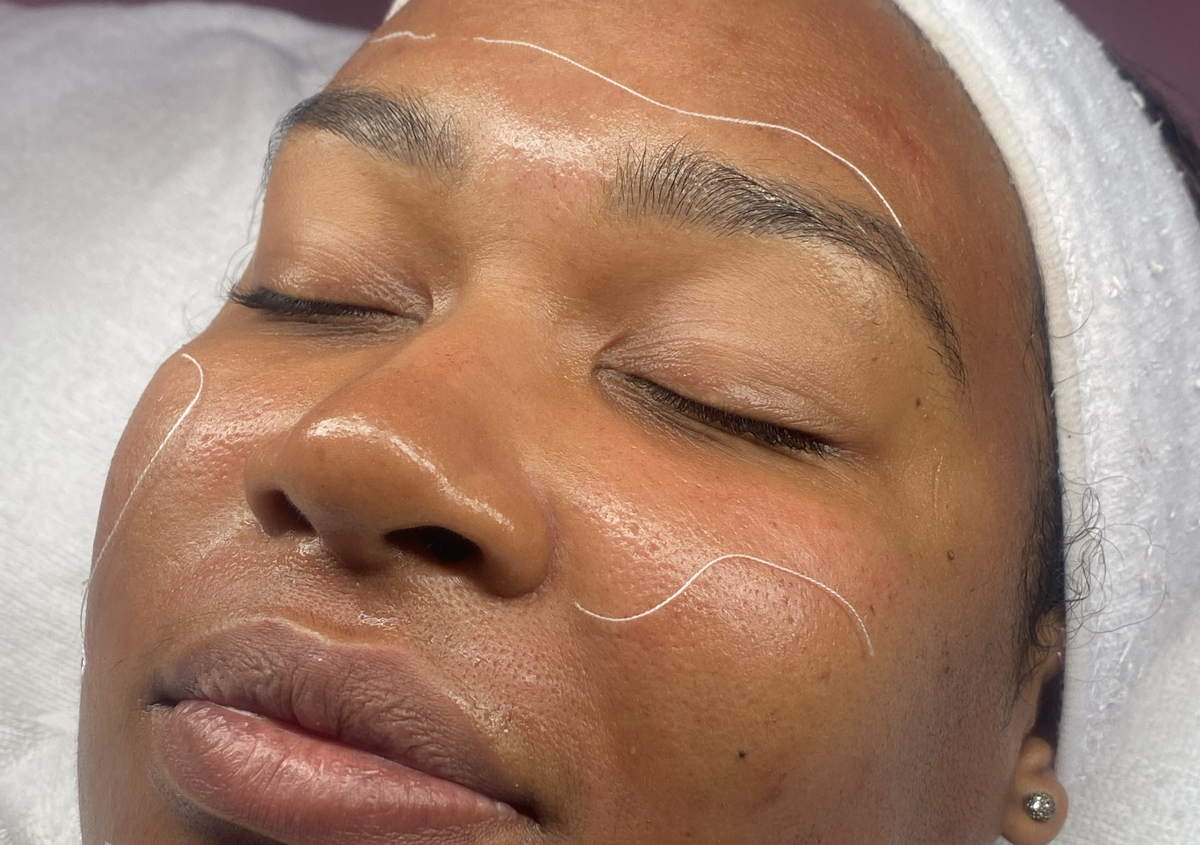 Protein Peptide + Protein Thread ( Korean Treatment)