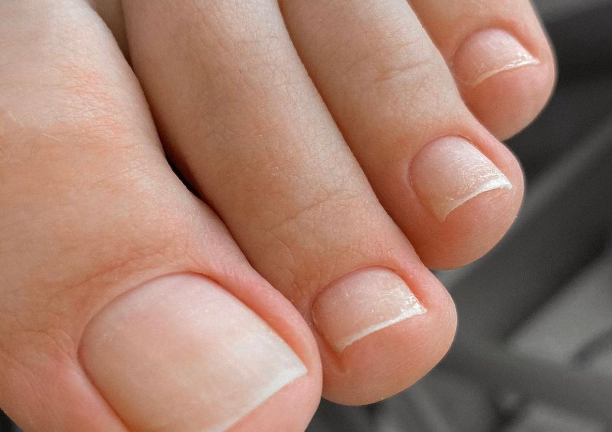 Dry Hygienic Pedicure(Full Foot Care)