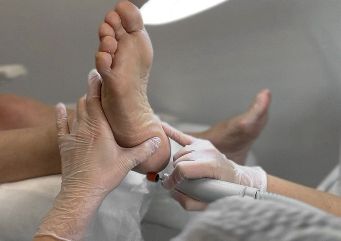 Pedichiură estetică bărbați