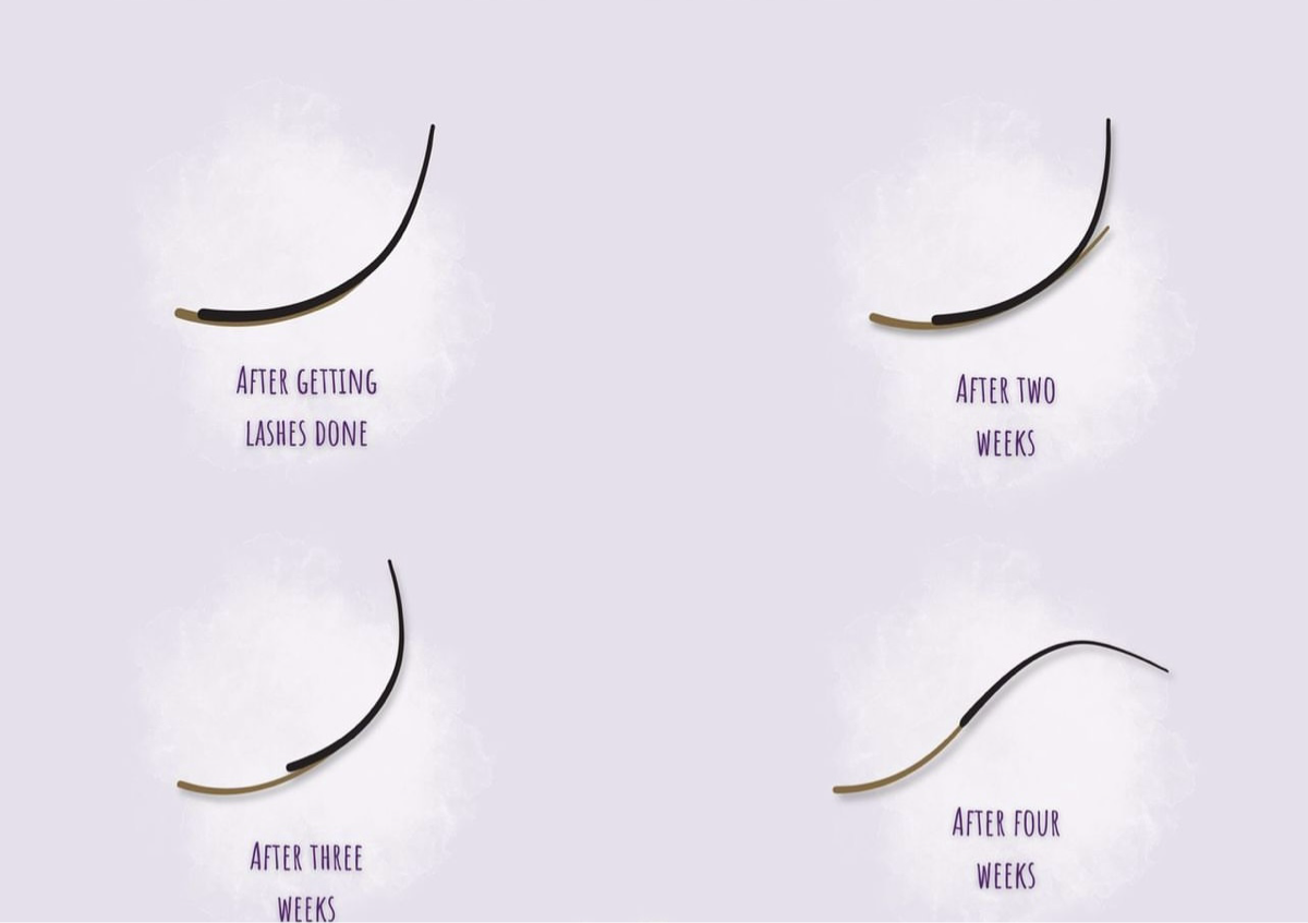 Volume refill (2-3 weeks)