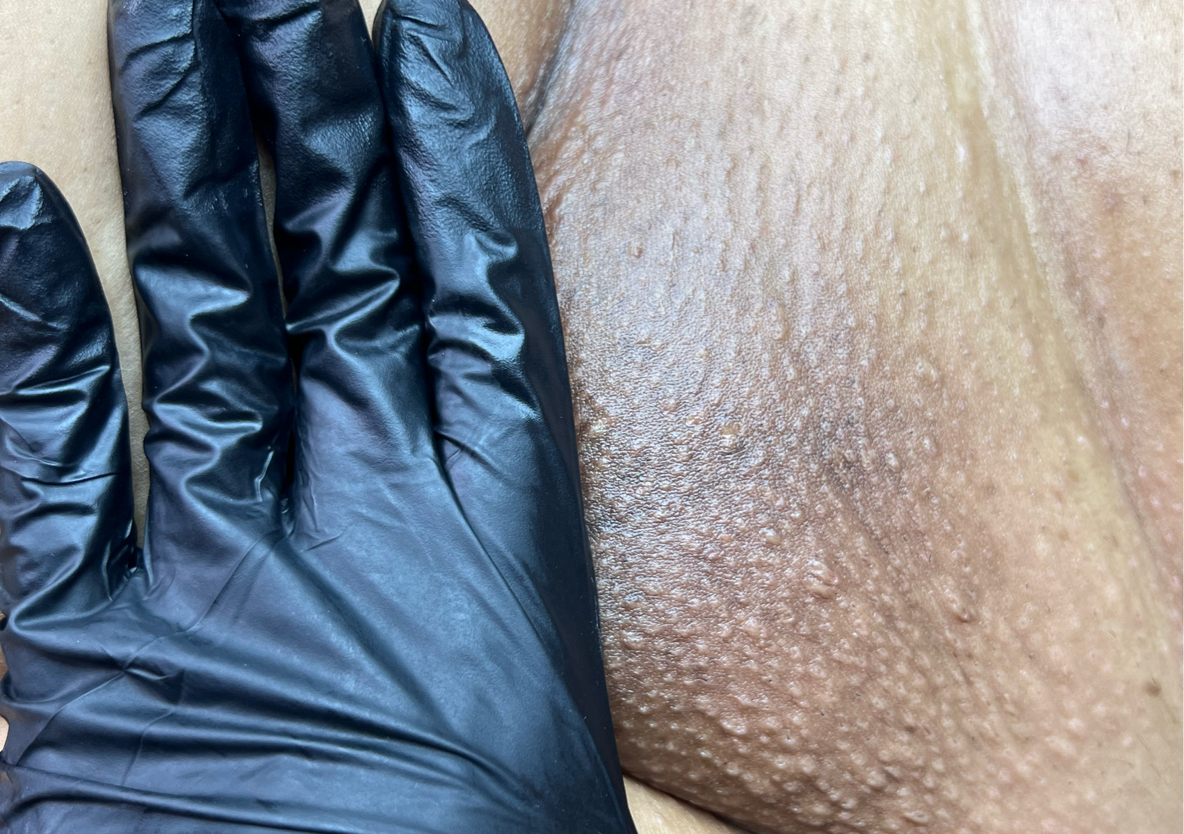 Brazilian Wax w/ full Vagacial 