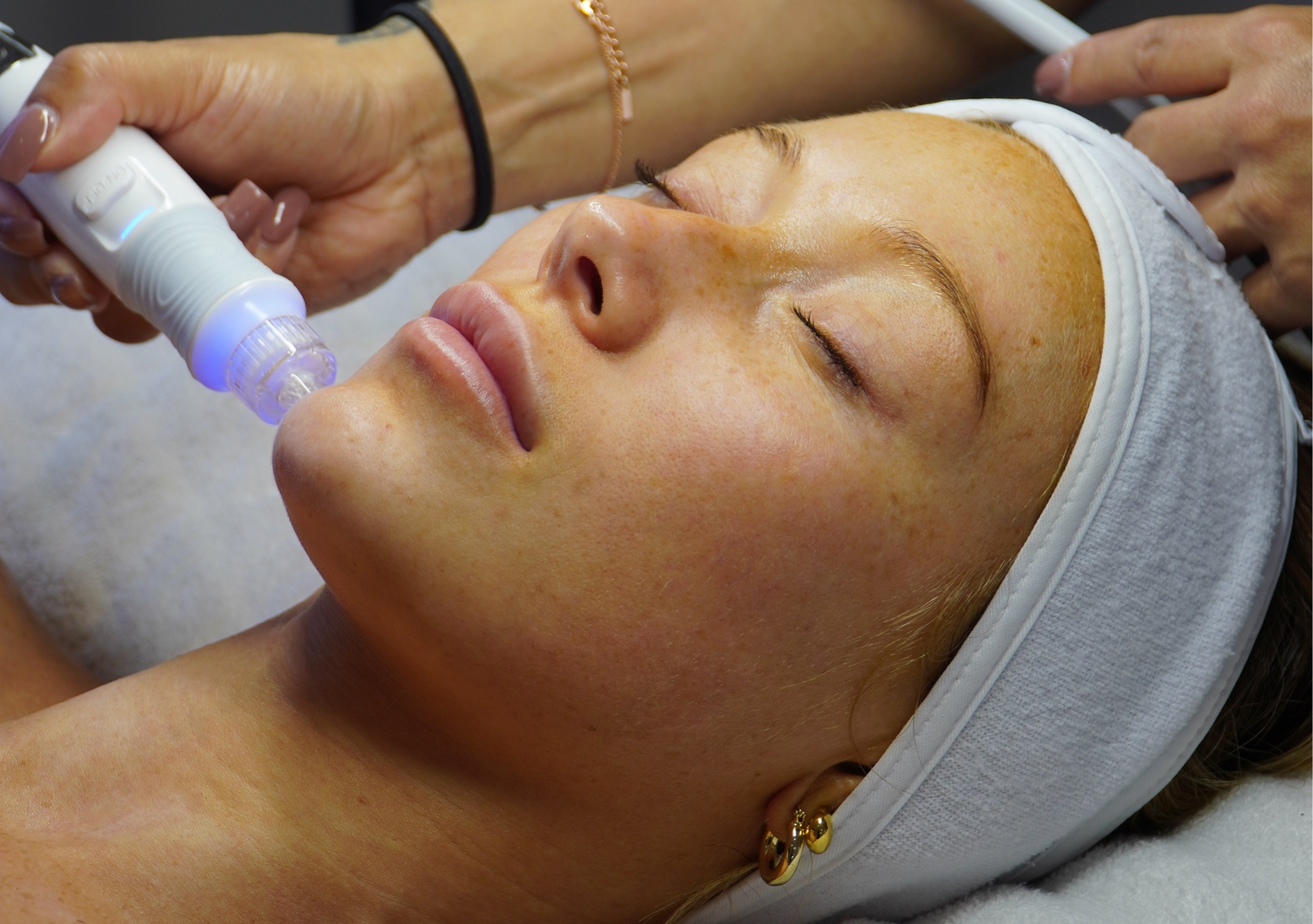 Hydradermabrasion 