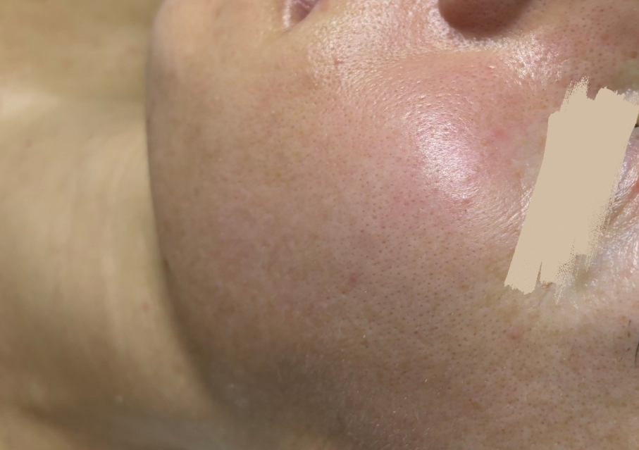 Elixir rejuvenecedor celular 