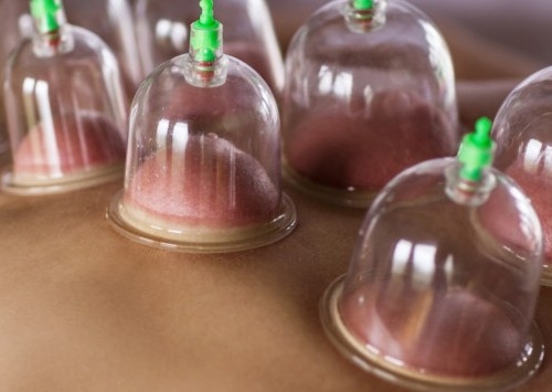 Cupping/Red Light Therapy Machine 