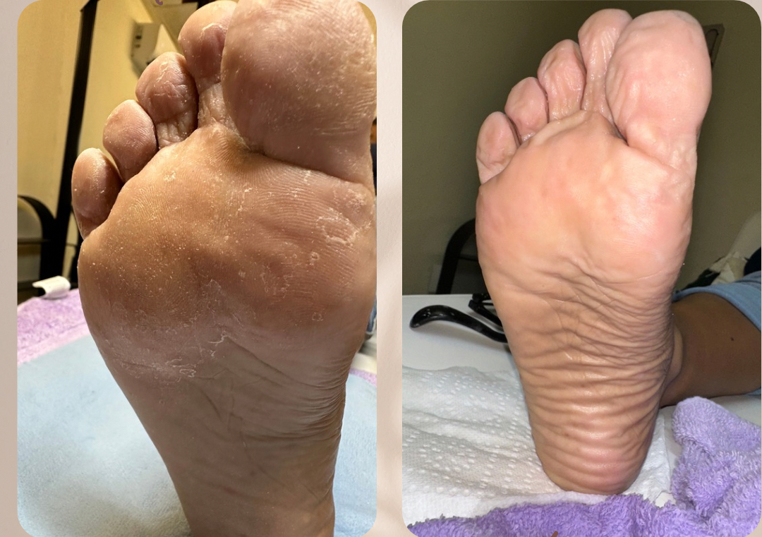 Pedicura con esmaltado en gel 