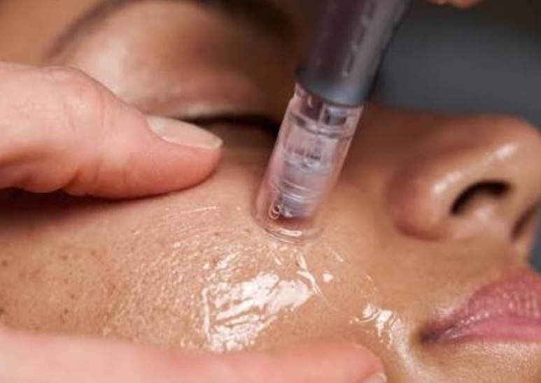 Nano infusion facial