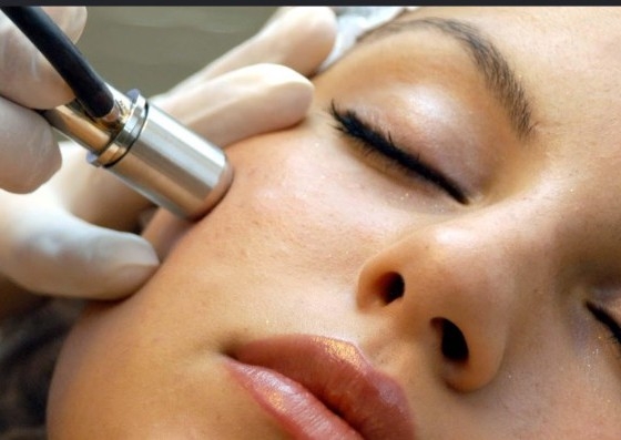 Microdermabrasion facial