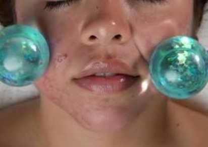 Arctic Facial 
