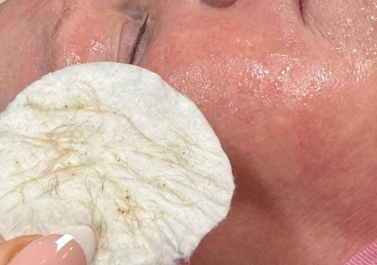 x 3 Dermaplaning Facial