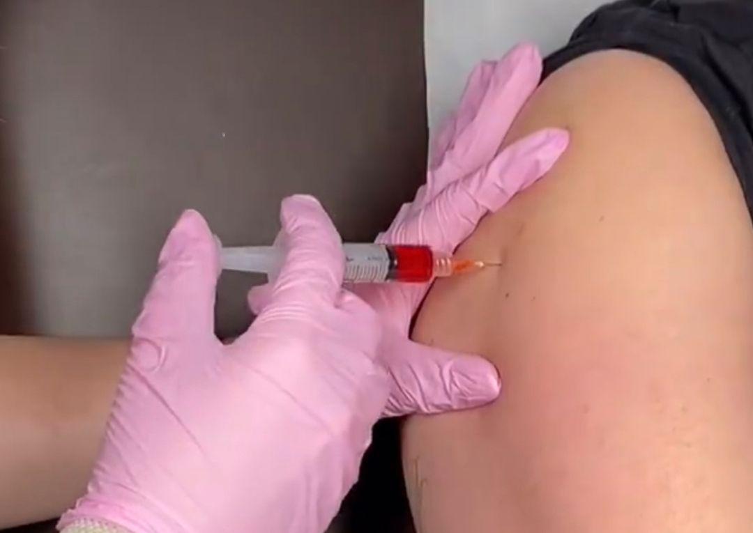 x 4 B12 Injections