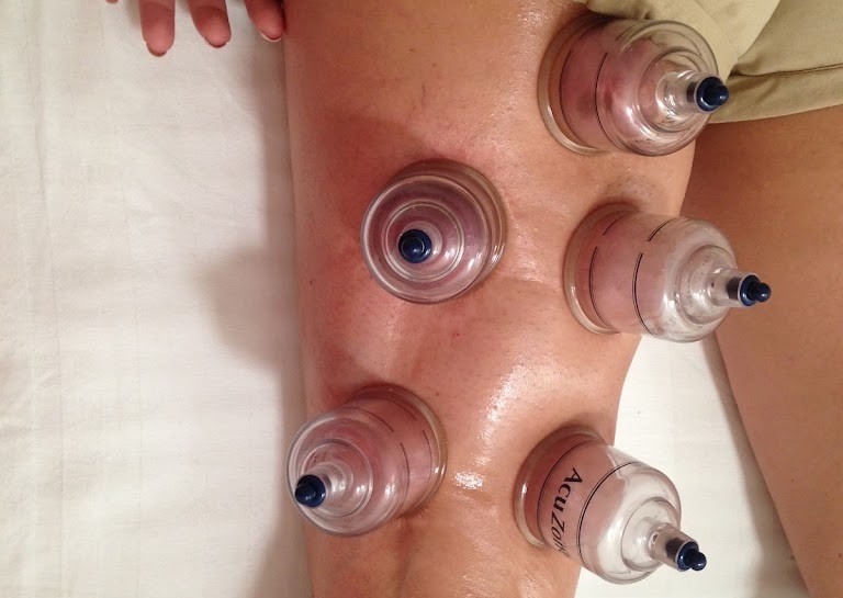 Consultation - First appointment for two