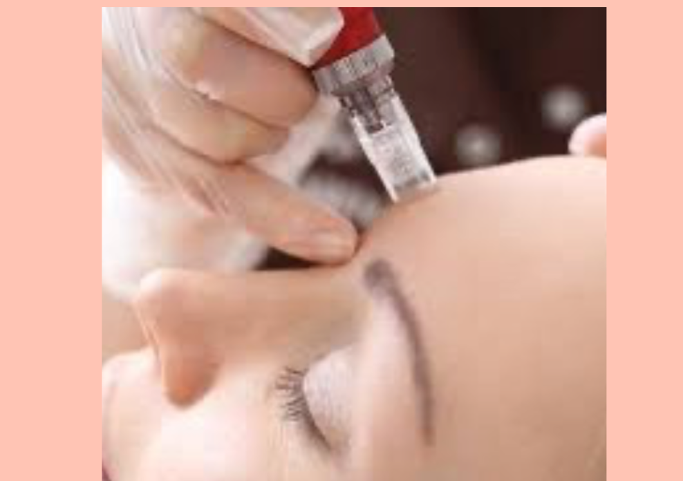 Mesotherapy facial 
