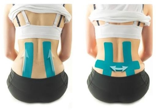 Precut Kinesiotape x 5cm x 20cm x 10 strips