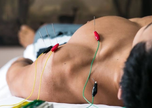 Massage and Acupuncture 1 Hour and 10 mins