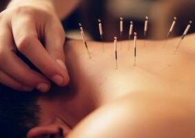 Western Acupuncture/Dry Needling ~ 1 hour 10 min