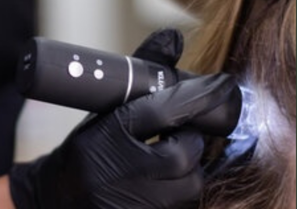 Diagnoza scalp si fir de par si tratament scalp