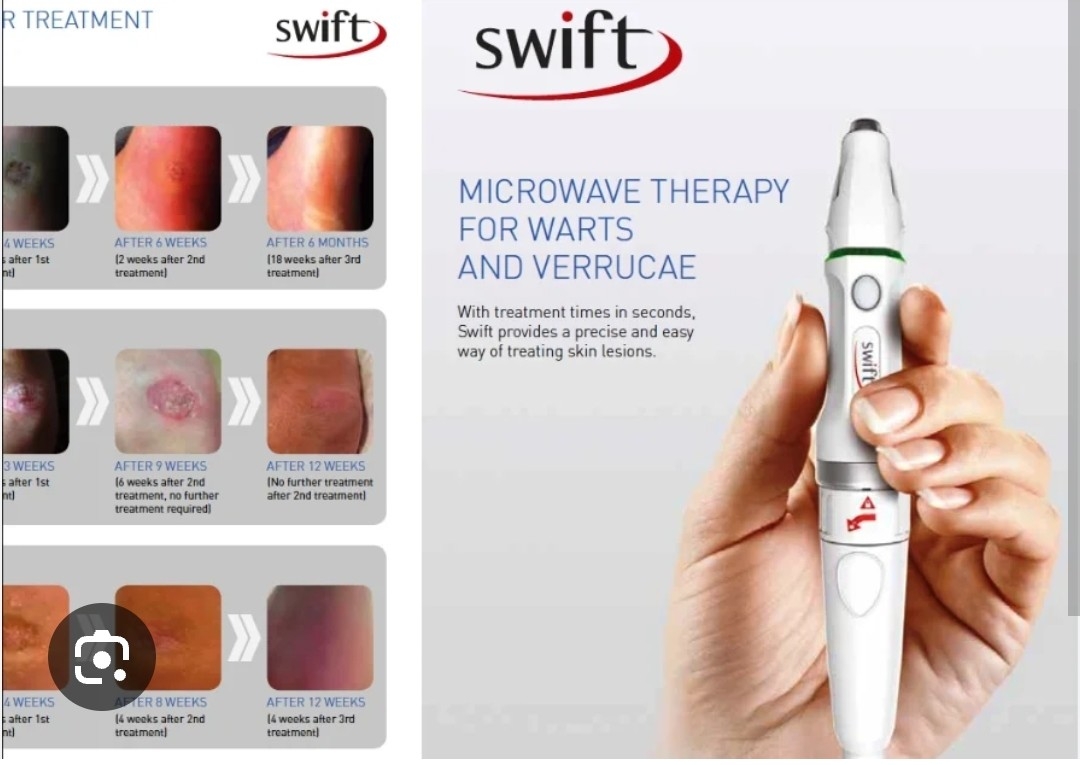 Swift treatment 1st treatment