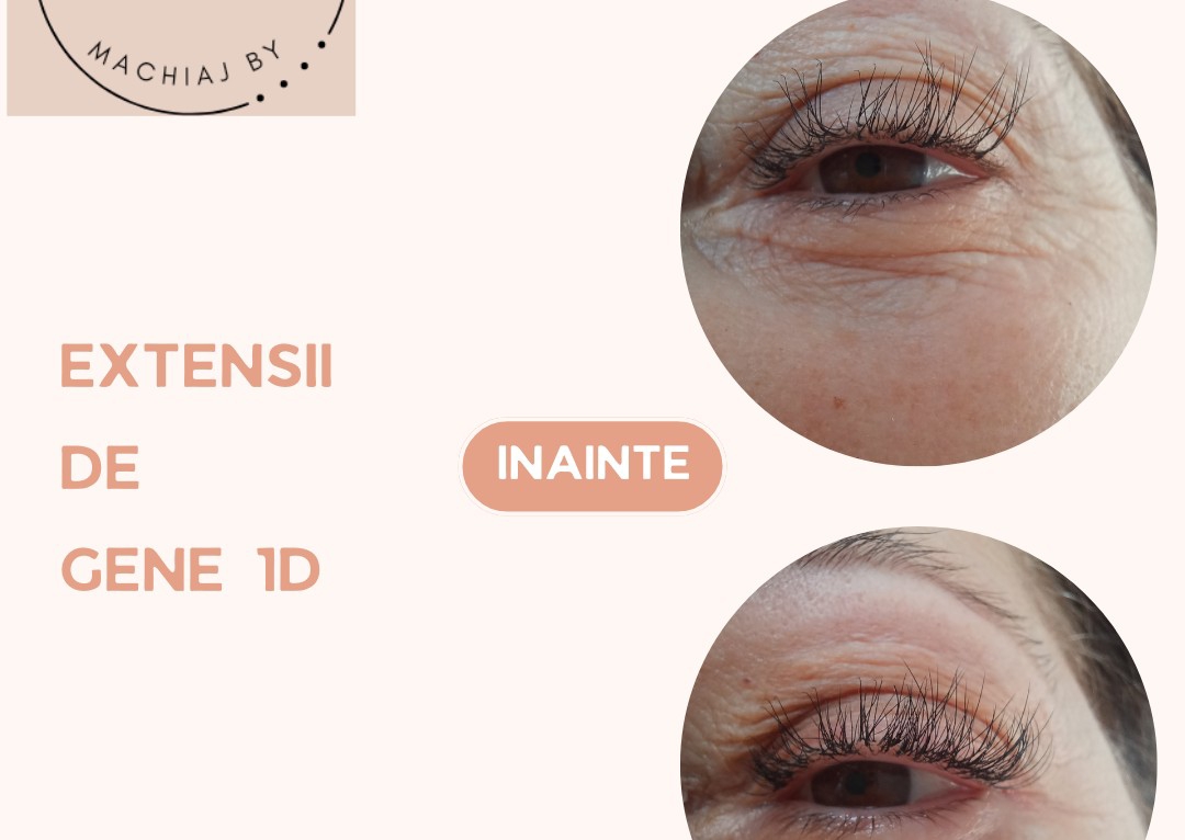 Extensii gene  întretinere