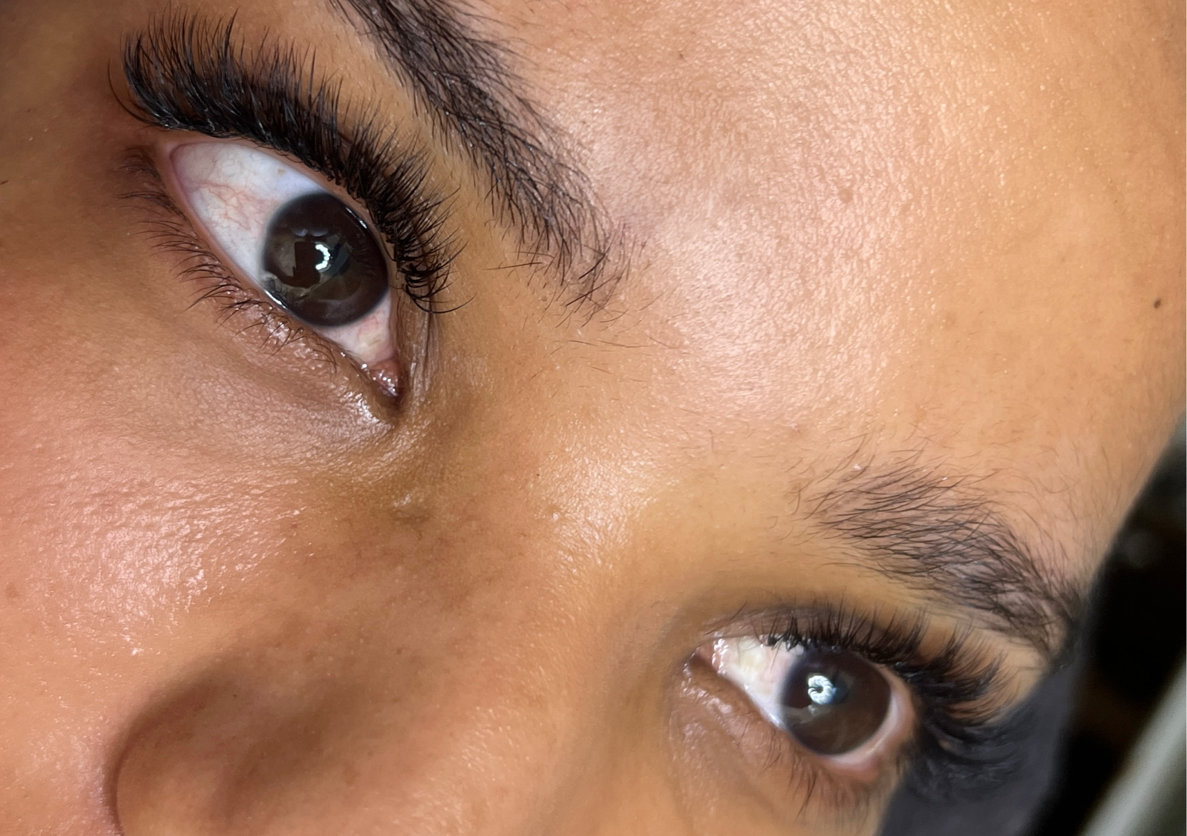 Hybrid Lash infill